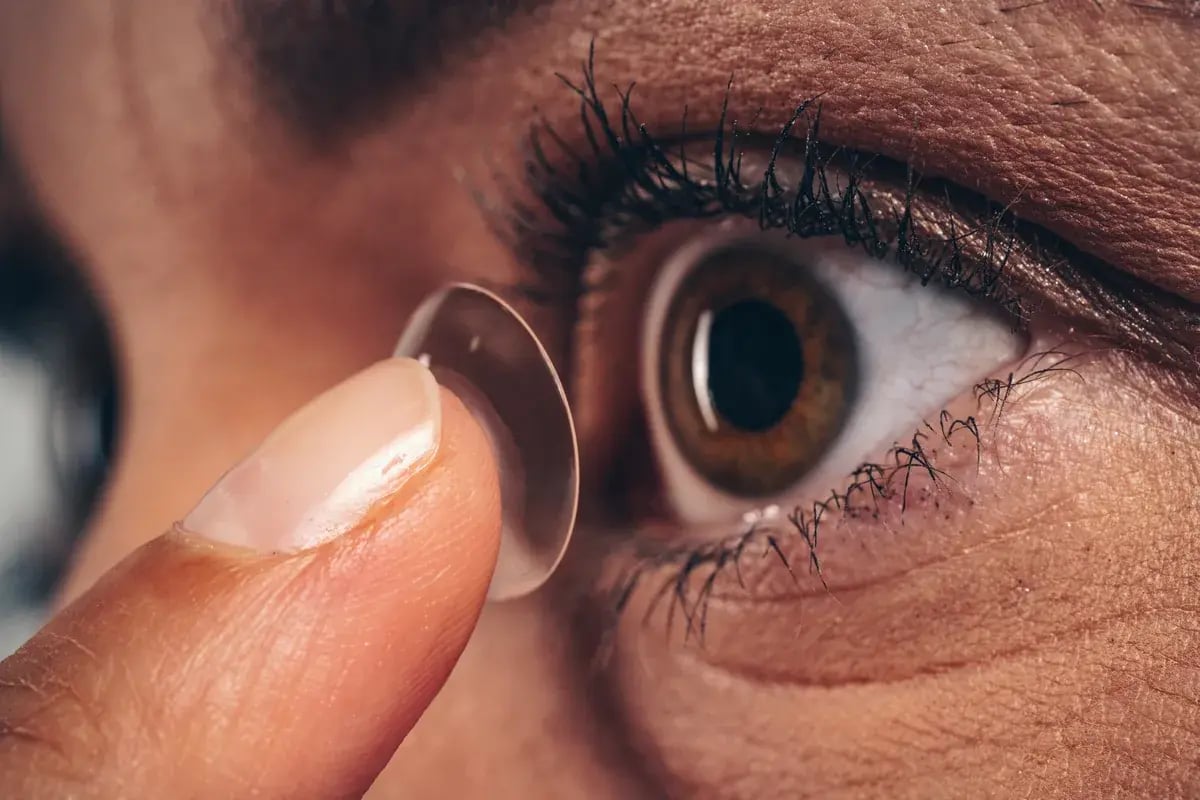 Nahaufnahme: Person setzt eine transparente Kontaktlinse ins braune Auge ein